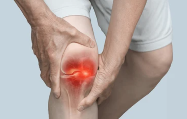 Joint Support Ingredients